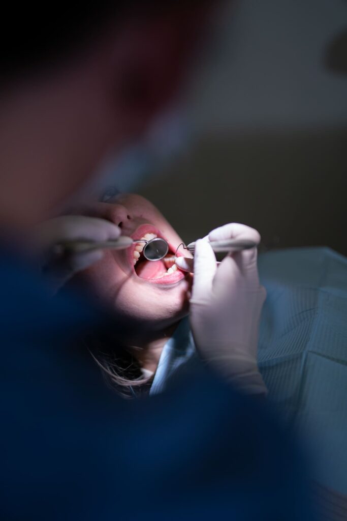 Implantes o Puentes Dentales